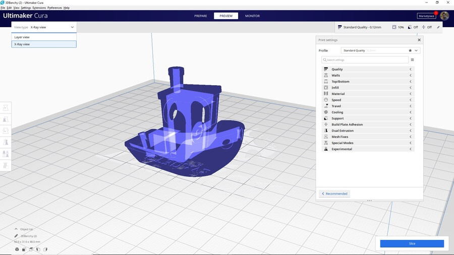 visión-rayos-x-cura